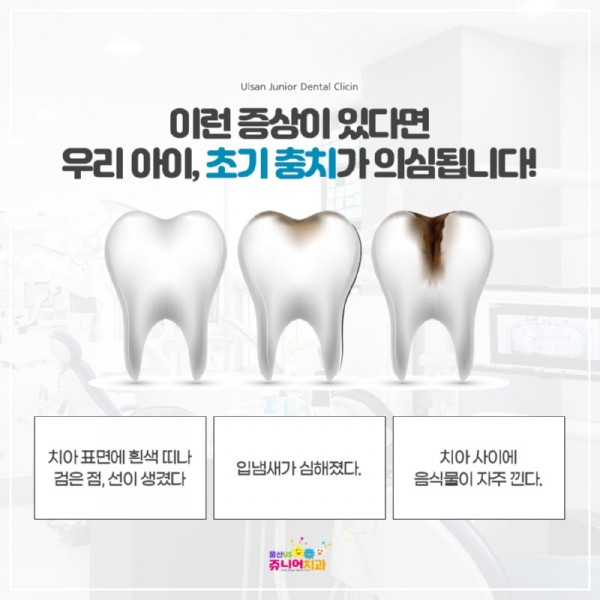 20221128-울산일산지치과-어린이충치치료(2).jpg